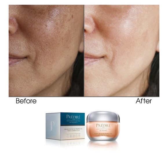 Peeling Facial New - Picture 3 of 3